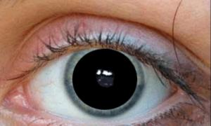 Тропикамид - ефективні очні краплі для діагностики та лікування