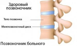 Біль в поперековому відділі хребта: діагностика та лікування